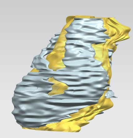 Fatty Tissue 3D